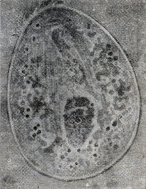 Рис. 30. Хилодон (Chilodonella cyprini).