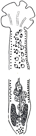 Рис. 29. Возбудитель кариофиллеза